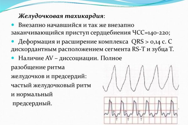 Удалился аккаунт кракен